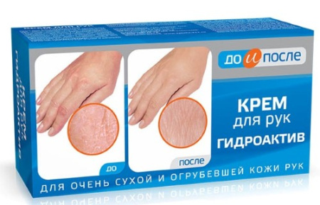 ДО И ПОСЛЕ Крем д/рук Гидроактив (сух кожа) 100мл