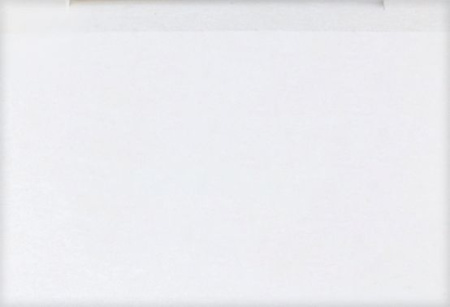 УРОДЕРМ мазь 30% 35г